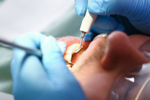 Best Emergency Dentist for Knocked-Out Tooth in Thayer, MO