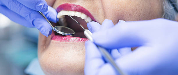 Best Broken or Cracked Tooth Emergency Dentist in Thayer, MO